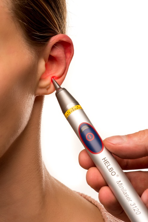 Ohrakupunktur mit dem HELBO Minilaser